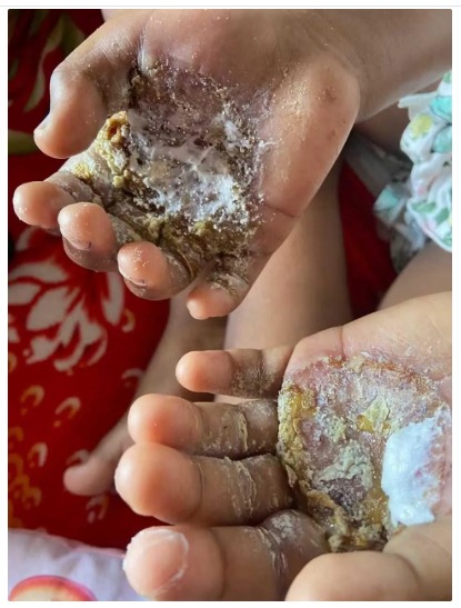 Polícia prende mãe por torturar a filha com ovo em estado de fervura em Niterói